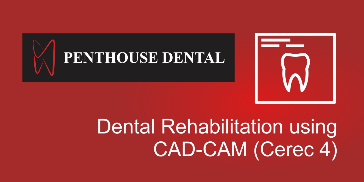 Dental Rehabilitation using CAD-CAM (Cerec 4) - Dentist Pretoria